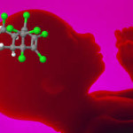 Endocrine Disrupting Chemicals and the Autistic Brain