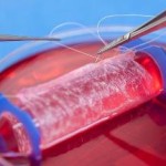 Are Teen Girls with Lab-Grown Vaginas Sacrificial Lambs?